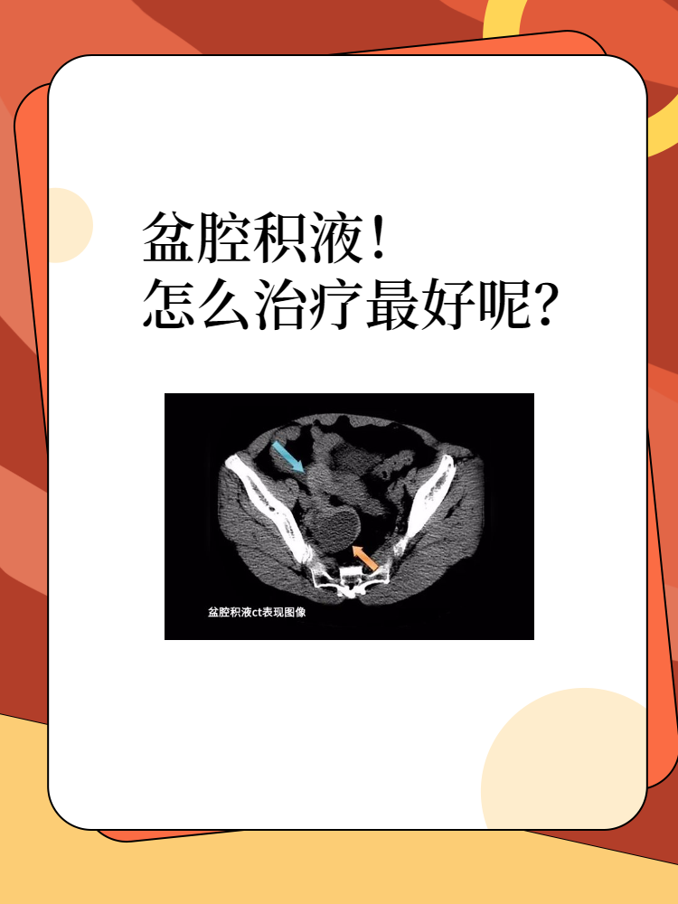 盆腔积液!怎么治疗最好呢