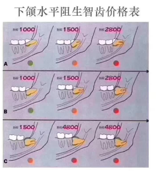 多生牙拔牙多少钱图片