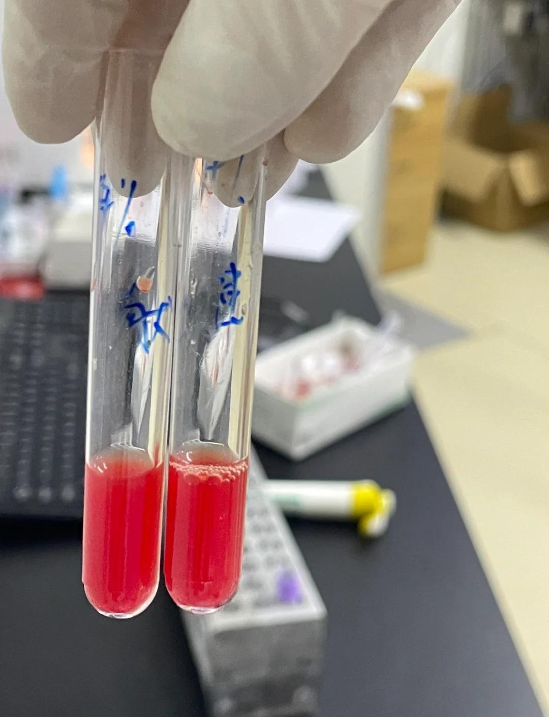 💉凝聚胺交叉配血法：实验步骤与结果解读
