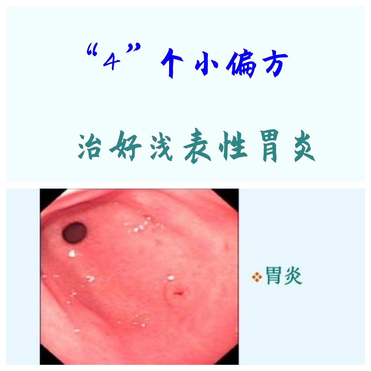 痢特灵治胃病偏方图片