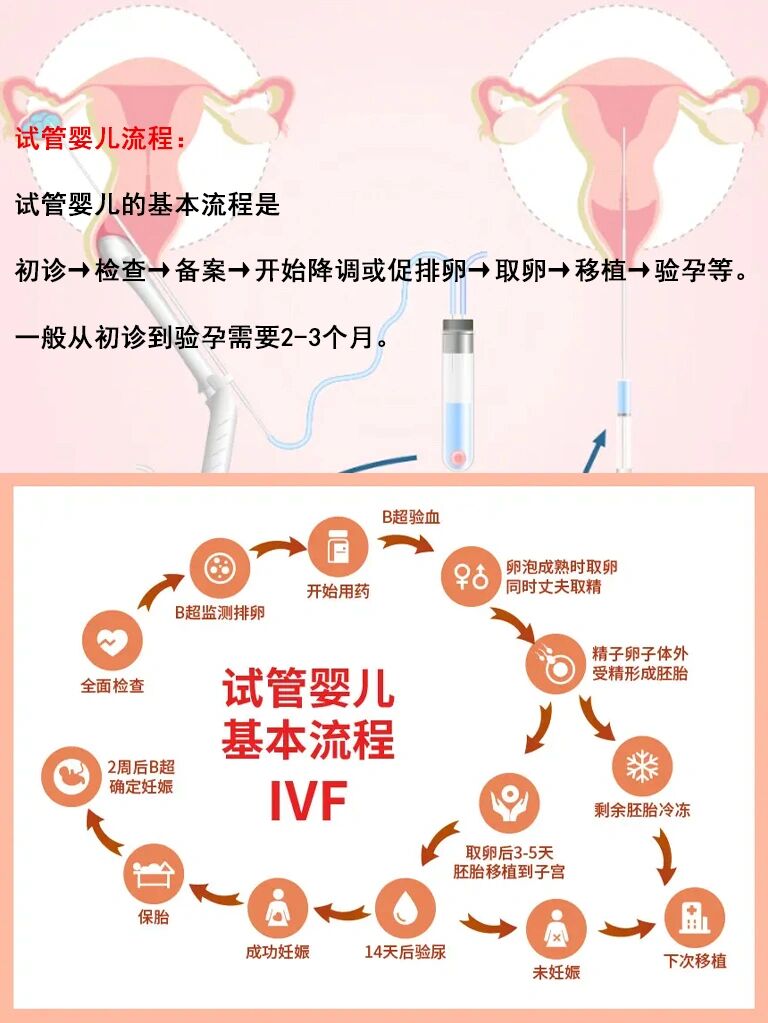 试管婴儿流程