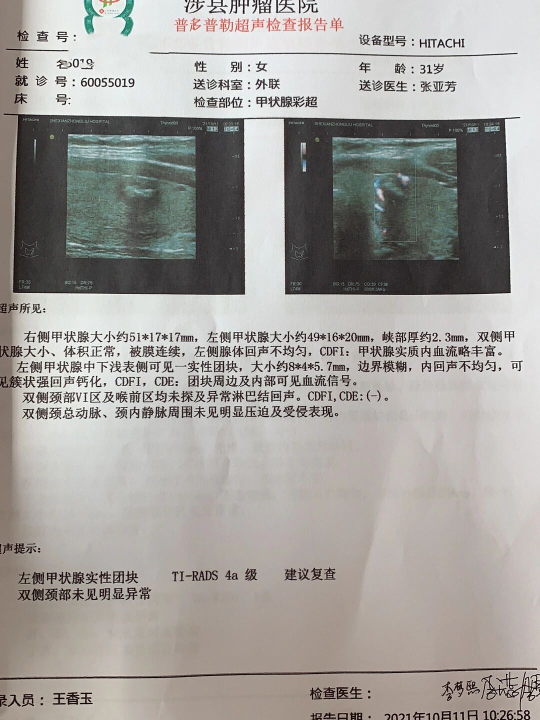 甲状腺结节多个医院超声结果,21年10月份体