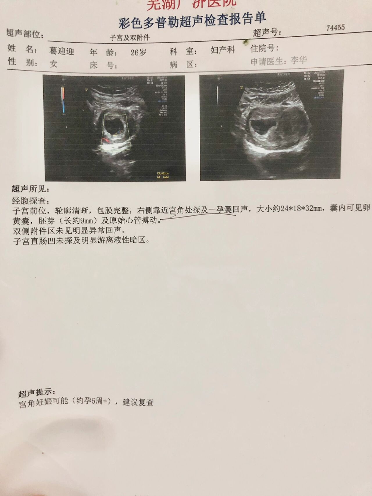 p 第一次怀孕 对于宫角妊娠这个词也是第一次听说03 br 孕6周的