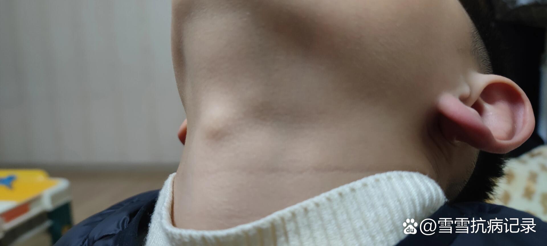 7岁半男孩长喉结