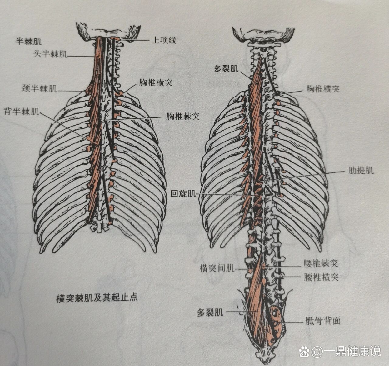 棘突横突图片