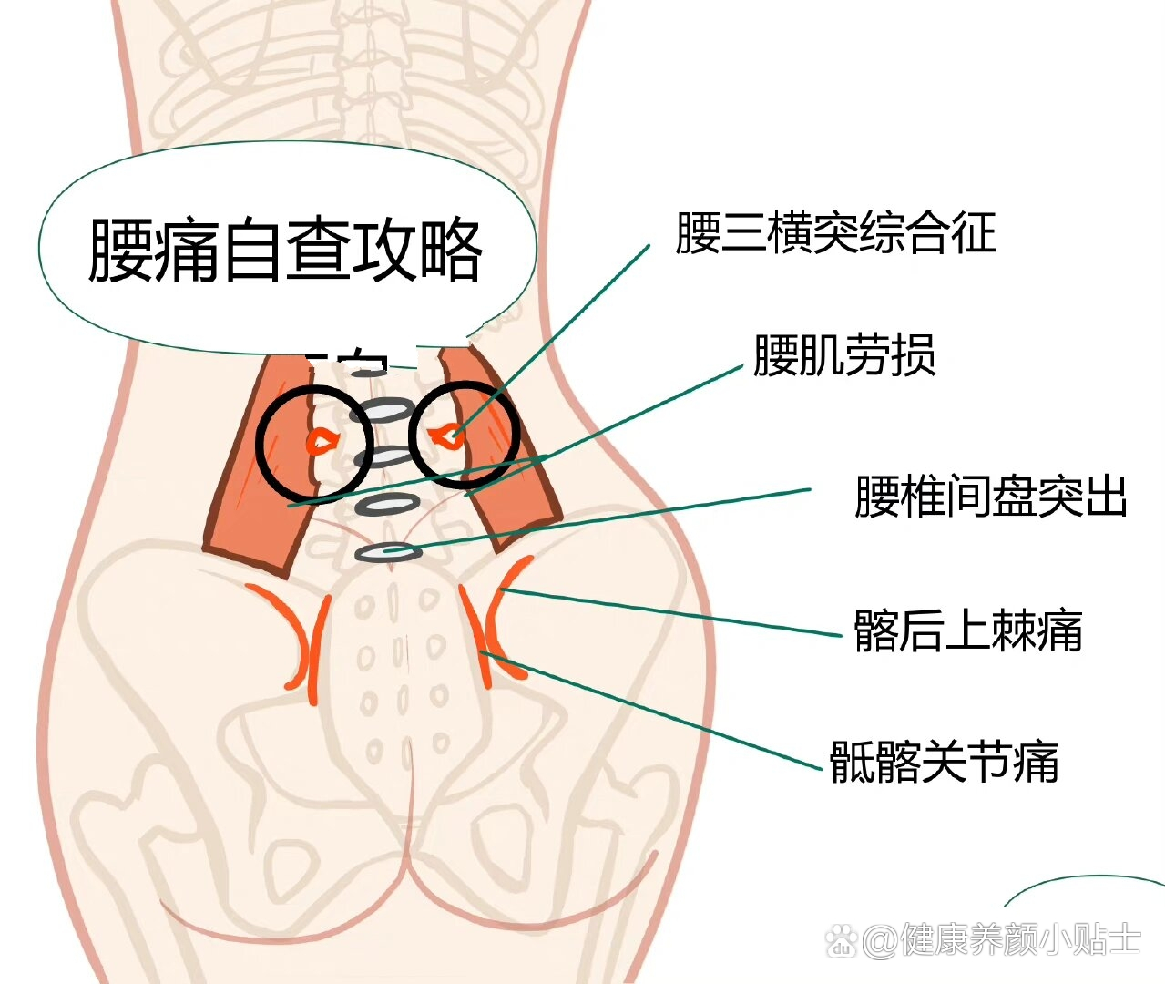 右后腰疼痛位置图详解图片