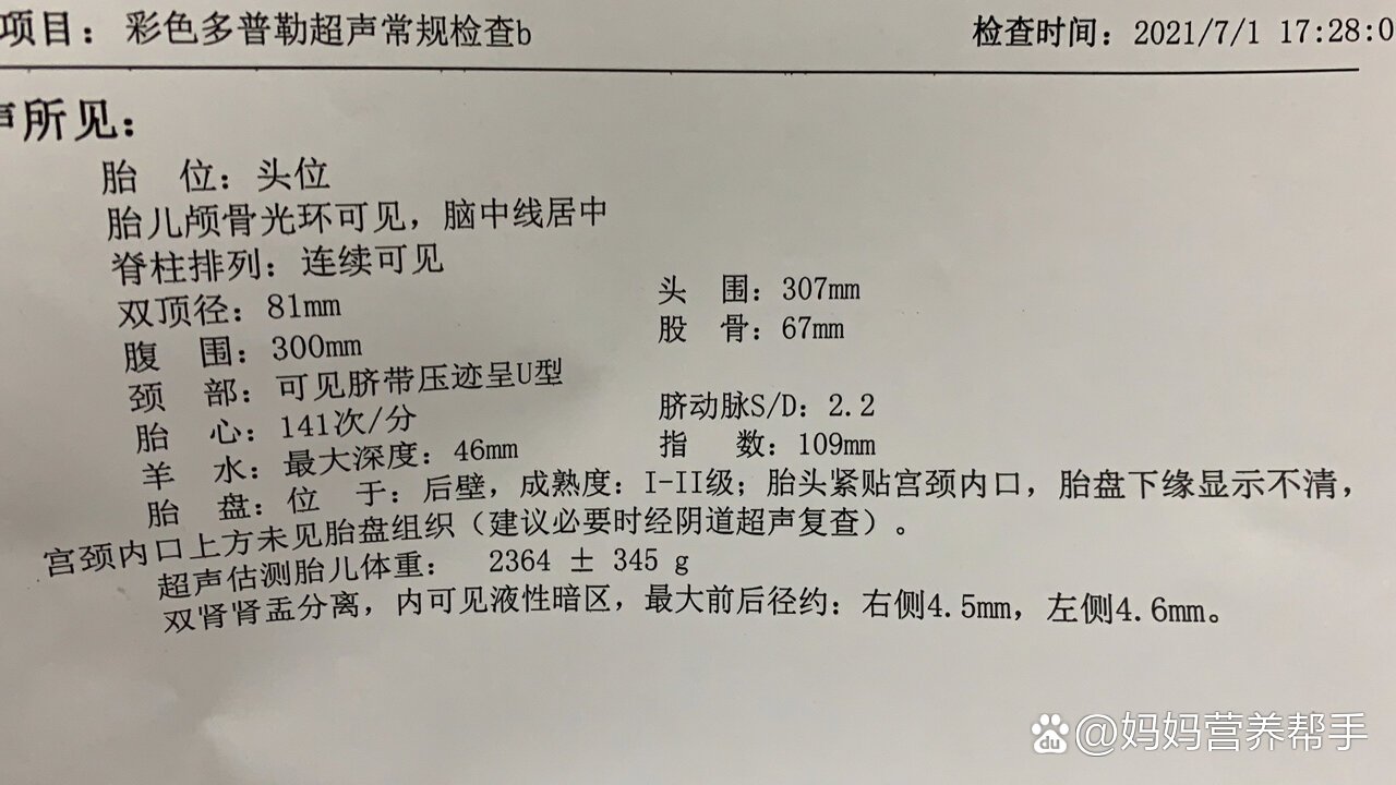 双顶径股骨大于3畸形图片