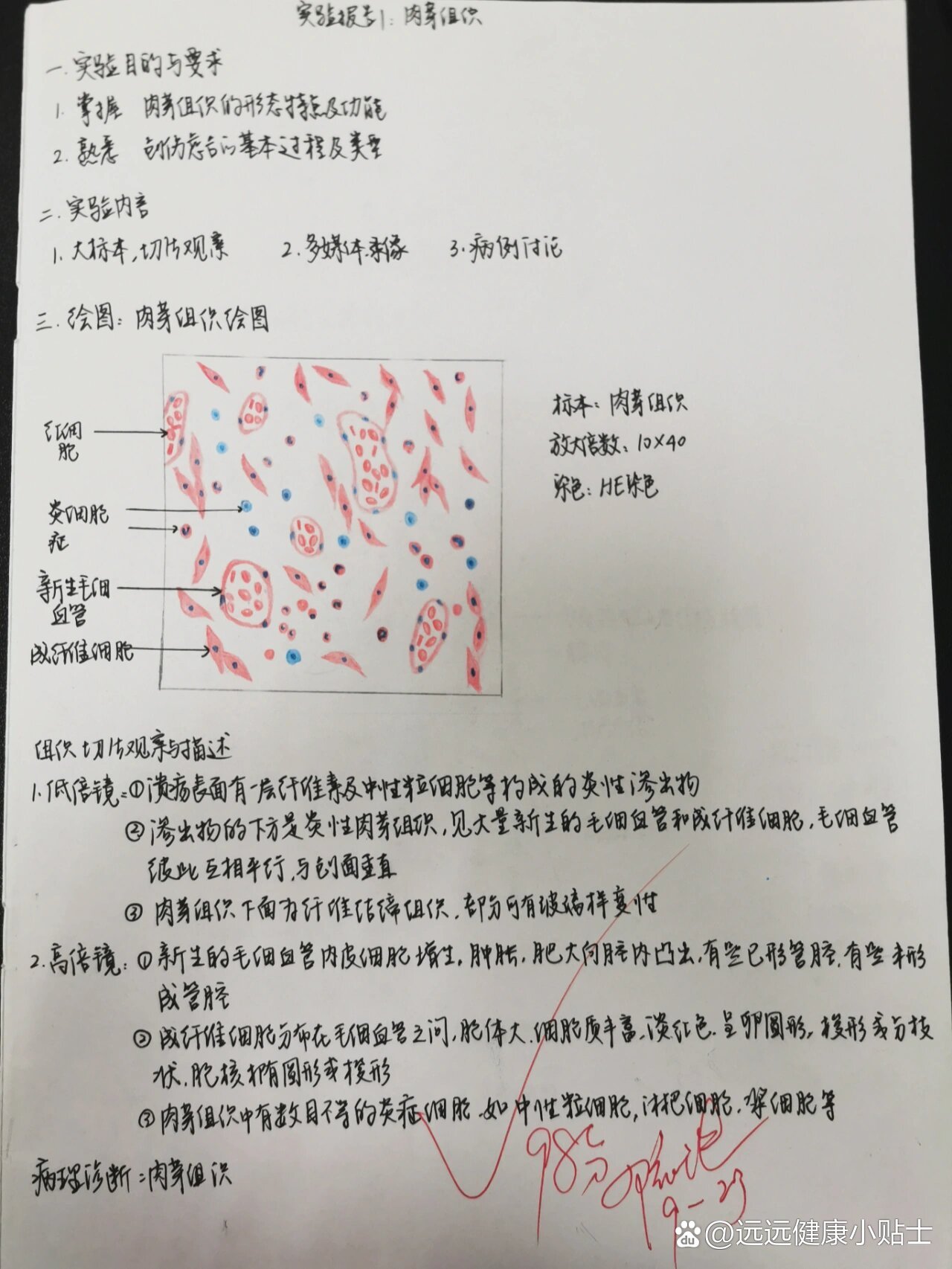 肉芽组织手绘图片