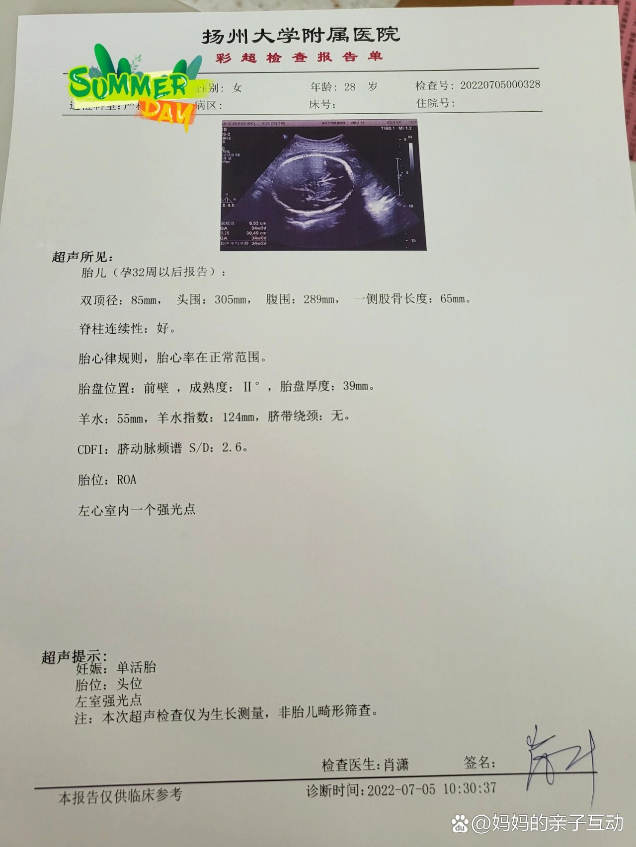 35周孕检胎儿大小和羊水数值都正常