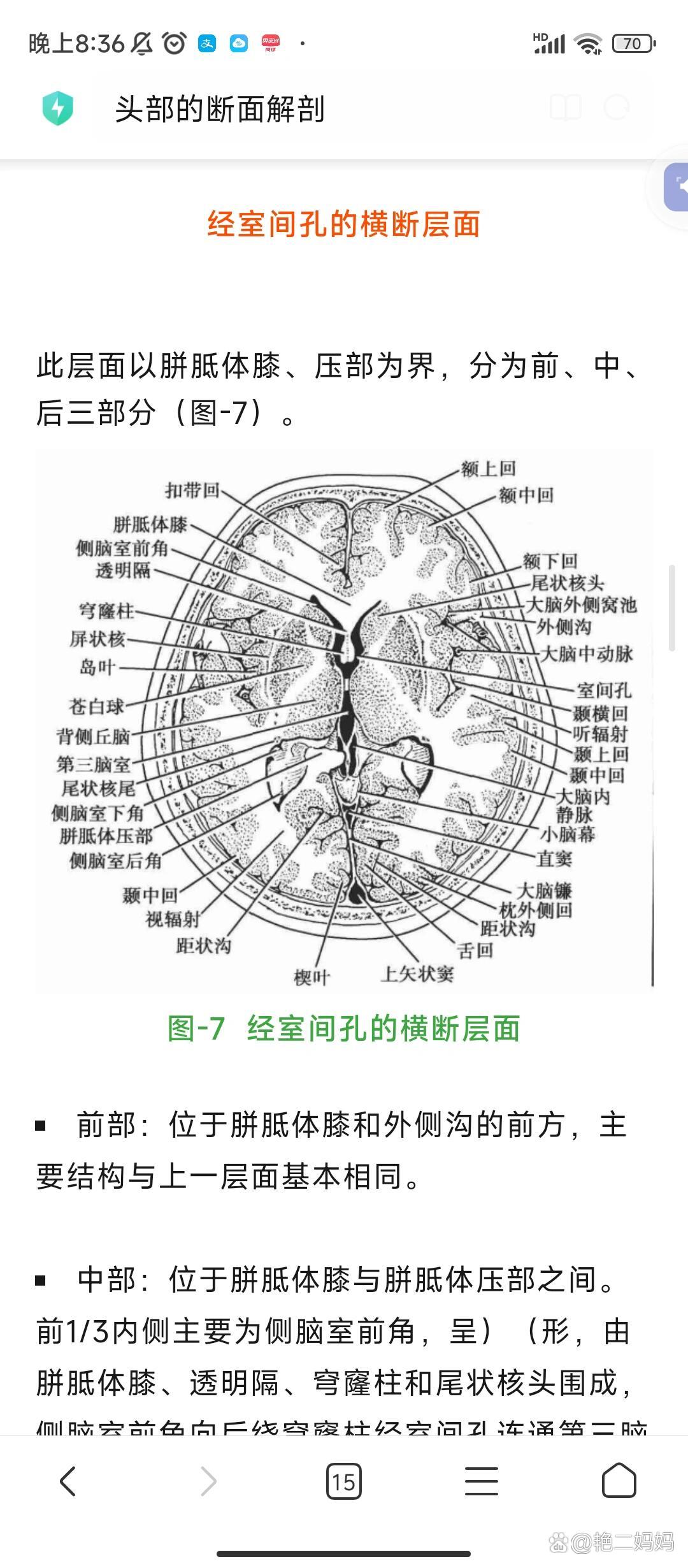 基底节区断层解剖图片