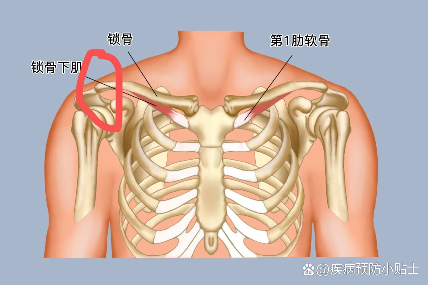 甲流or二阳后呼吸时左锁骨和左下几根肋骨疼