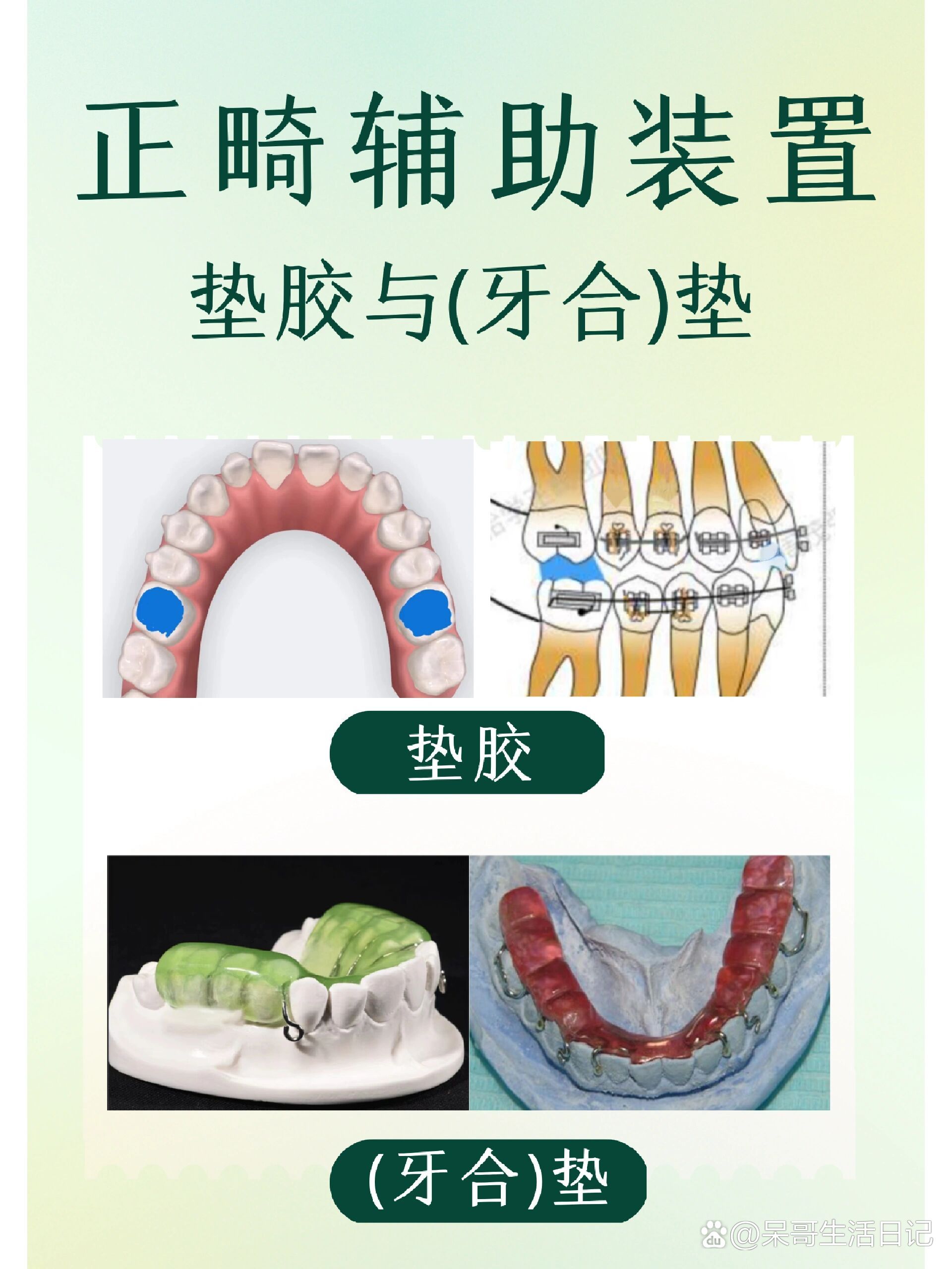 牙齿垫高图解图片