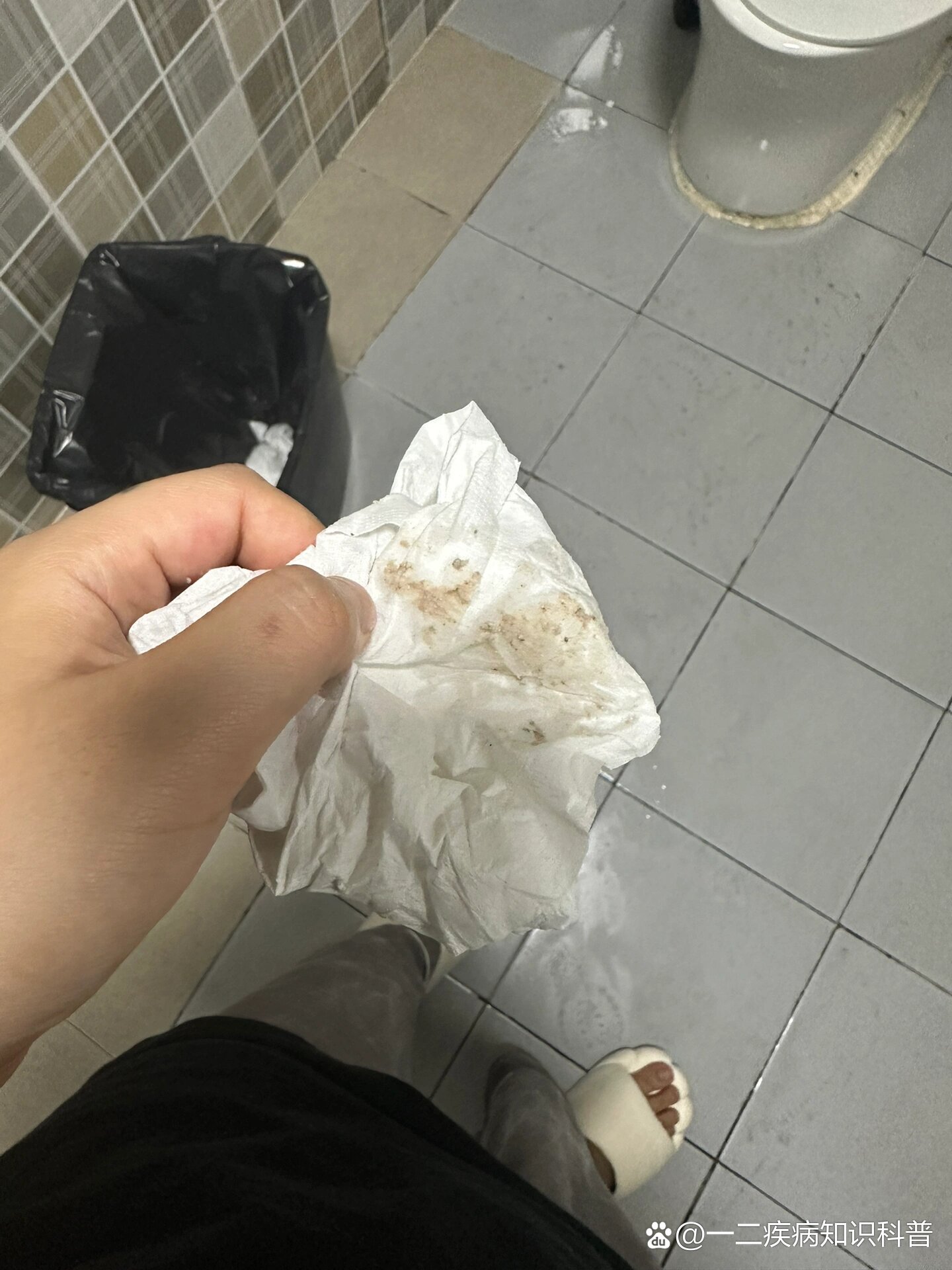 褐色分泌物退!