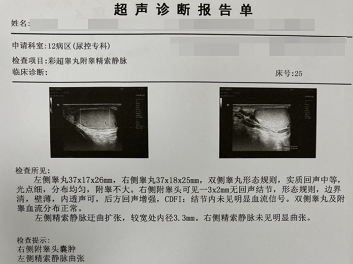 26岁男性患精索静脉曲张,无需手术即可痊愈!