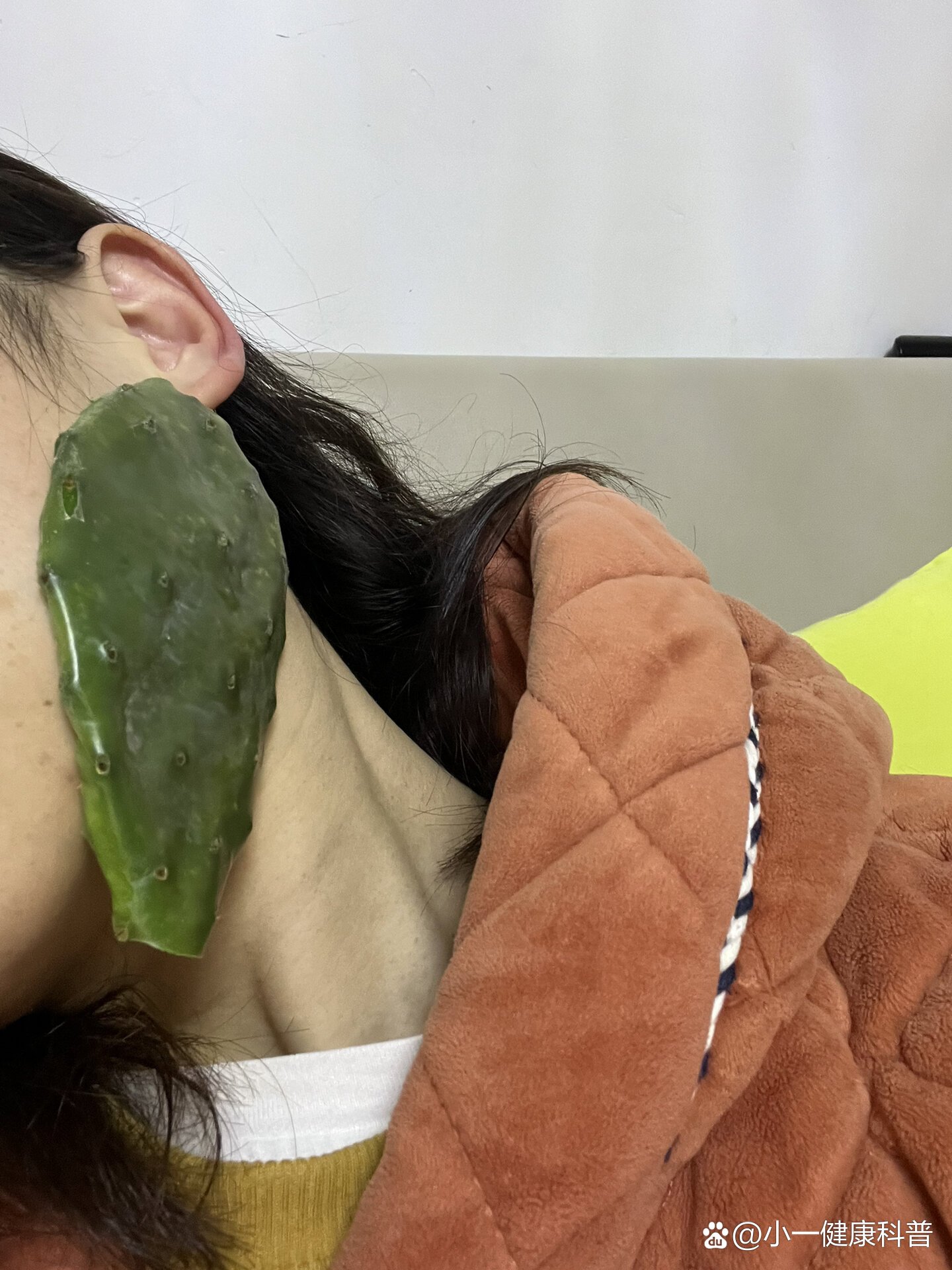 疑似得了腮腺炎的第一天,仙人掌🌵来解救