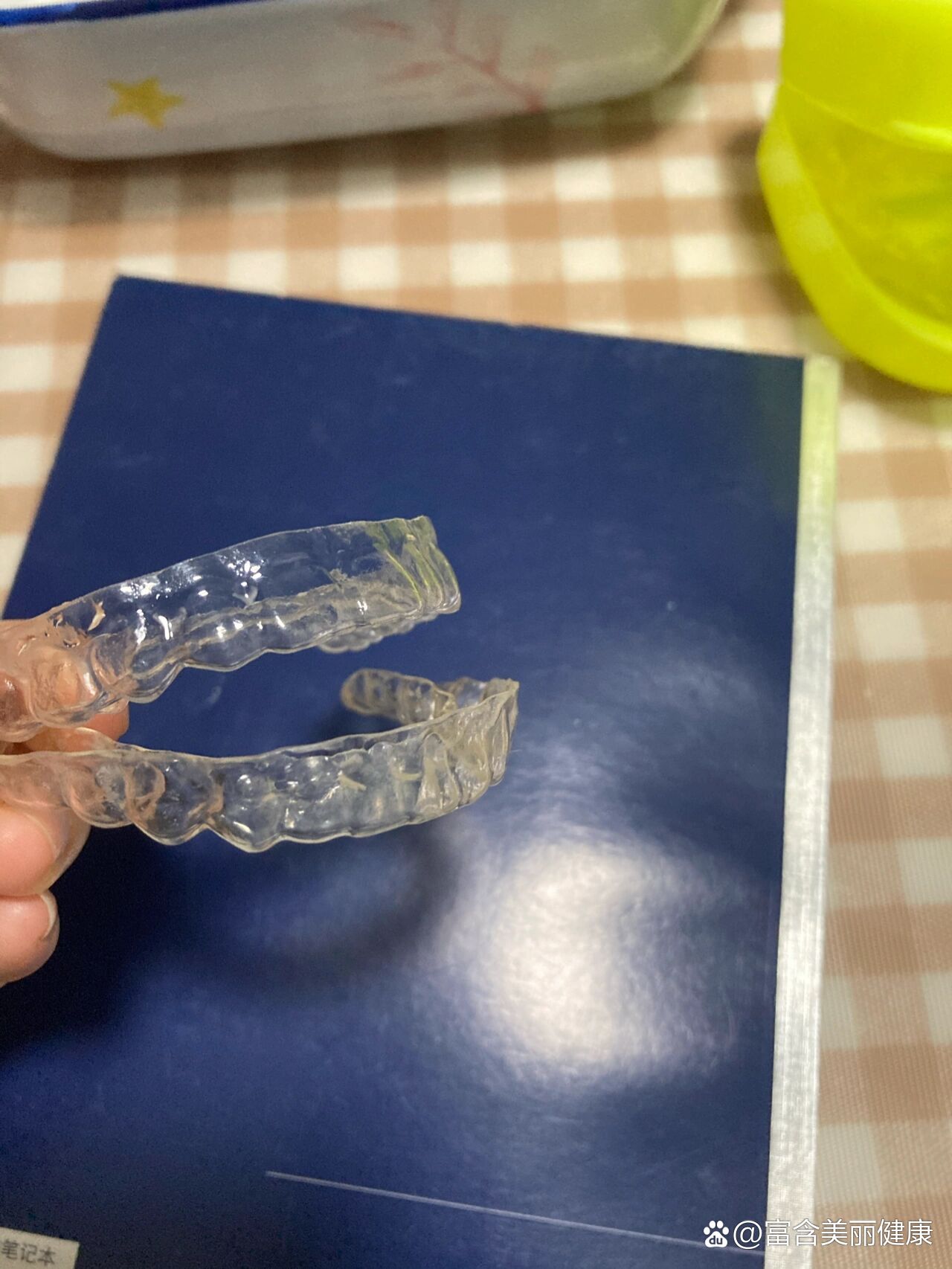 关于透明压膜保持器血泪史