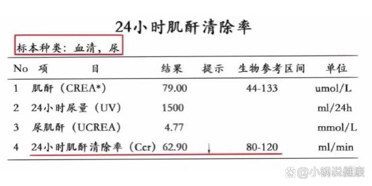 单纯肌酐偏高 无意义图片