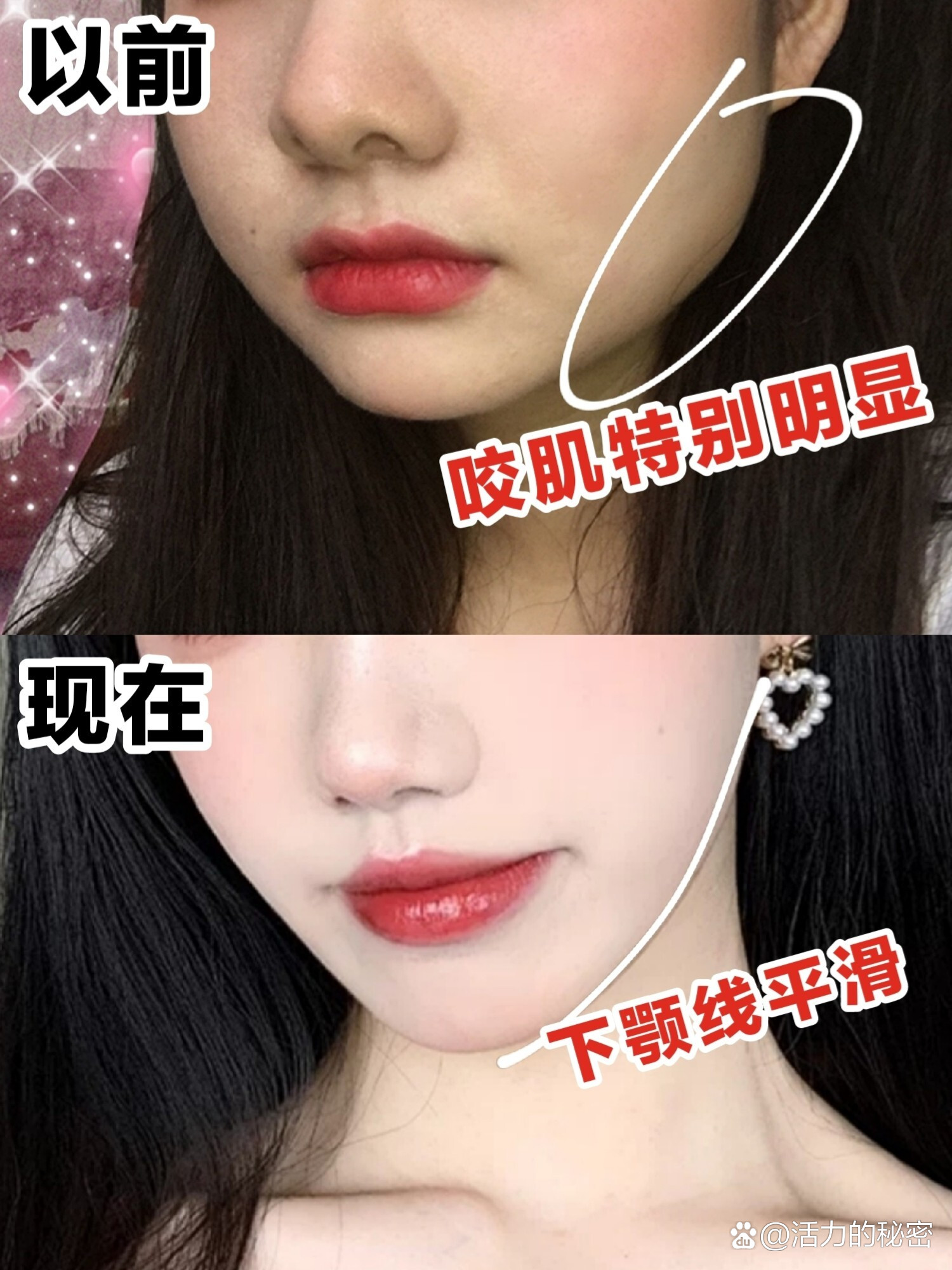 咬筷子提颧肌,提颧肌_大山谷图库