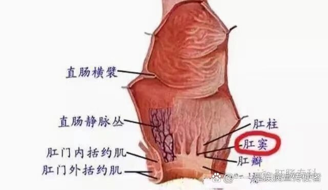 肛窦炎又称肛隐窝炎,是指肛门齿线部的肛隐窝炎症性病变.