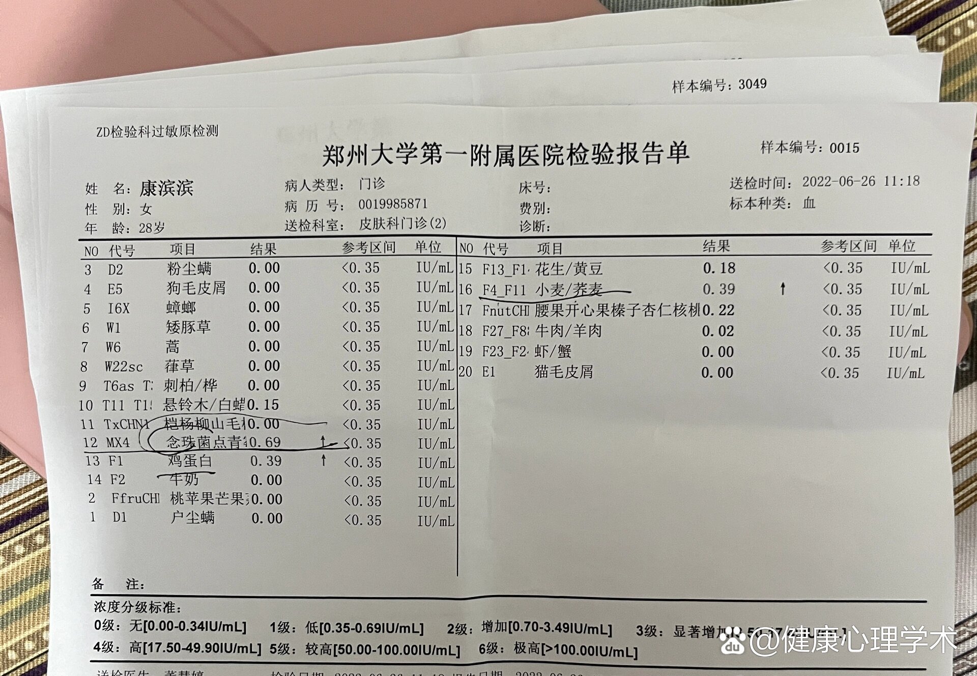 郑州大学第一附属医院～寻麻疹之过敏原检测