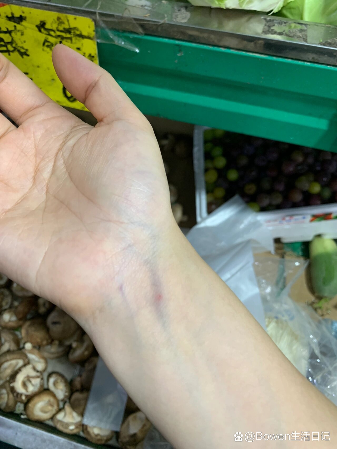 的抽血位置?br今天去做检查 医生说我血管太细了 就在手腕抽的