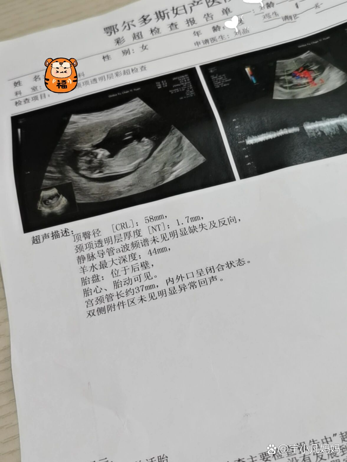 12周的孕反消失了,我的快乐回来了