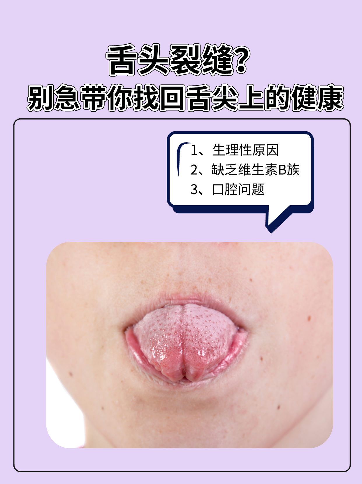 舌头裂缝?别急,带你找回"舌尖上的健康"!