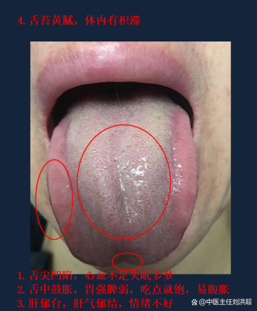 舌诊导图,中医手把手教舌诊,歌诀+详细图解,建议收藏!