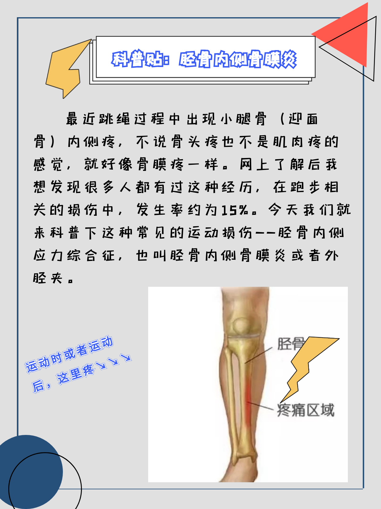 胫骨骨膜炎位置图片