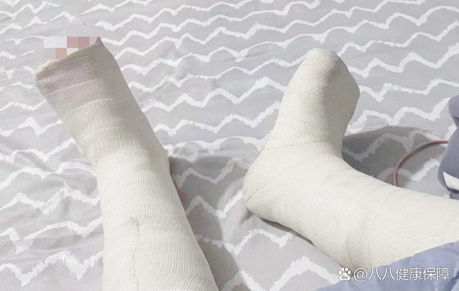 双脚骨折女大学生住院记