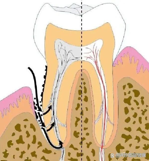 牙髓位置图图片
