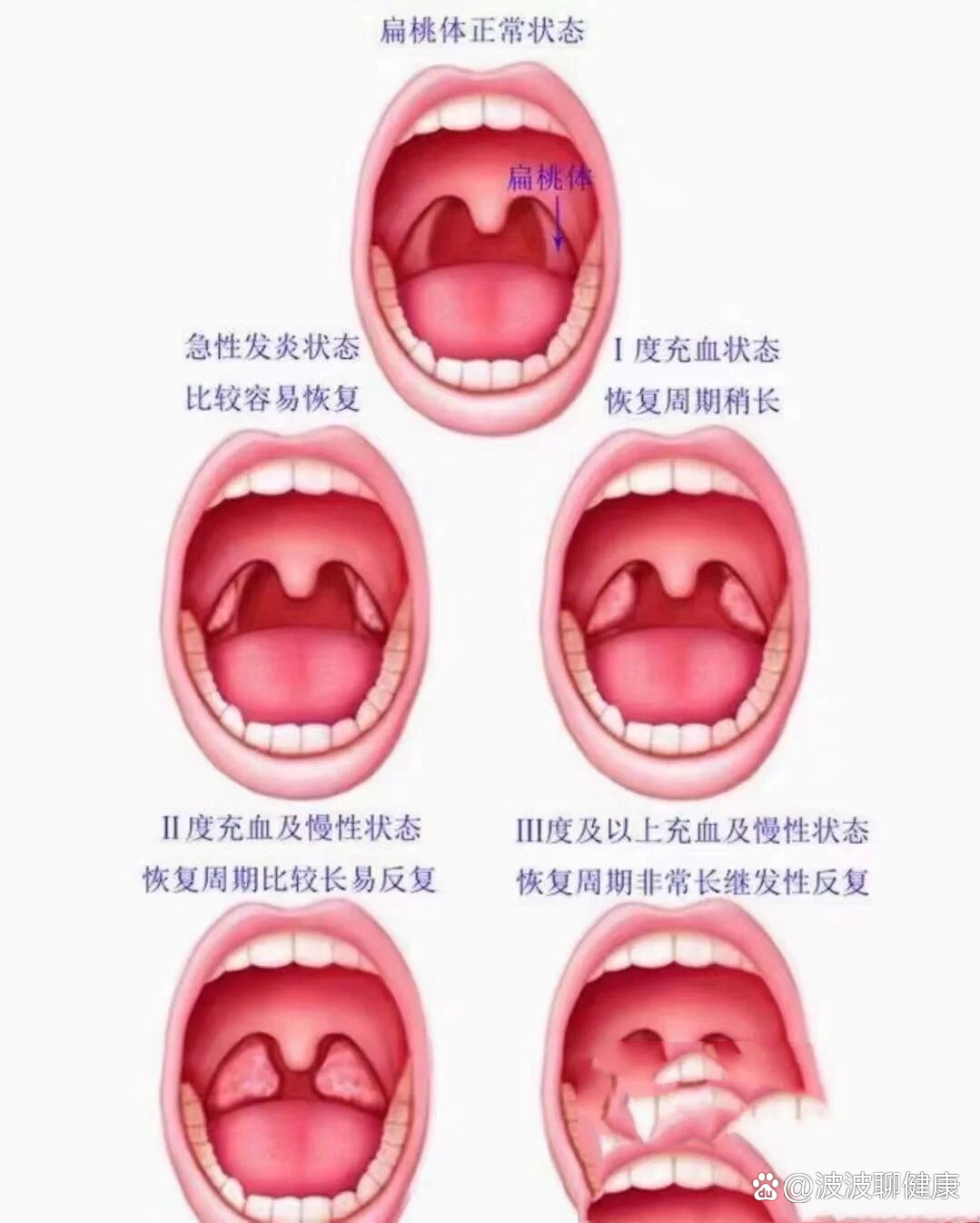 术后两周