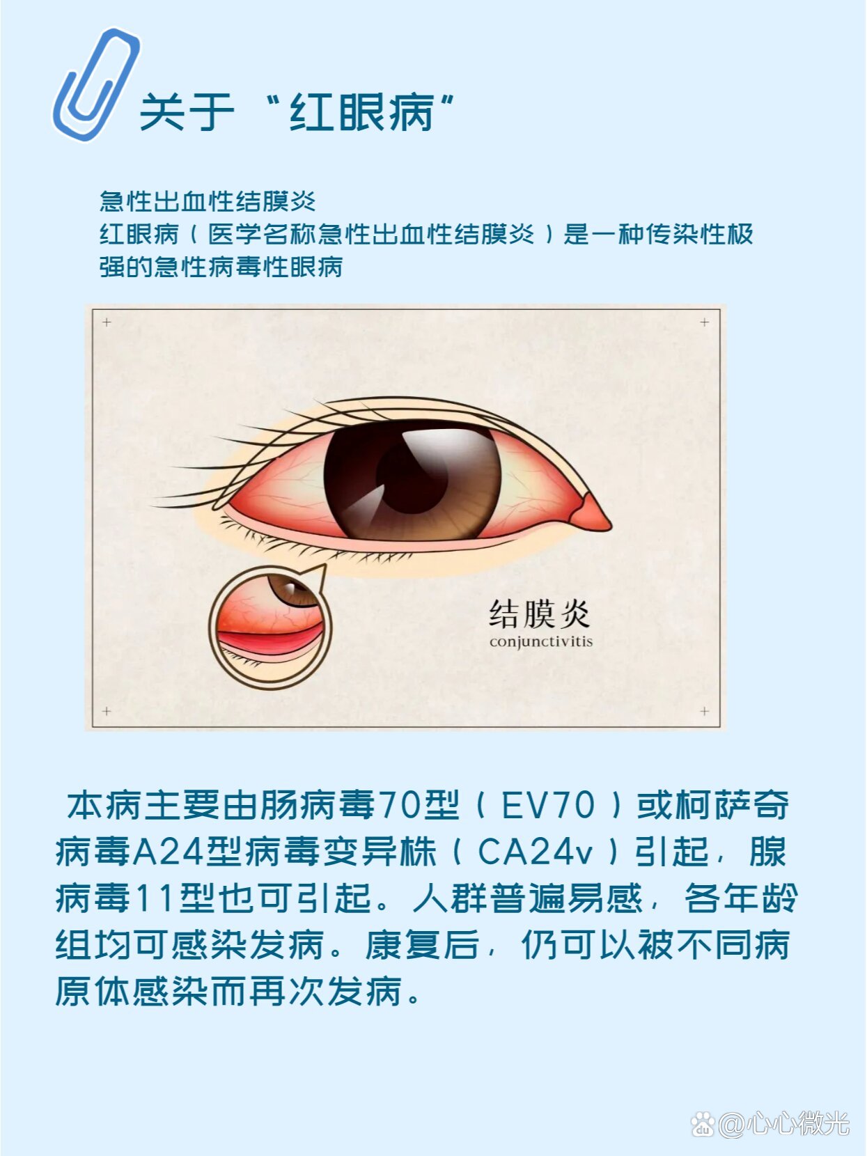 什么是红眼病 全网资源