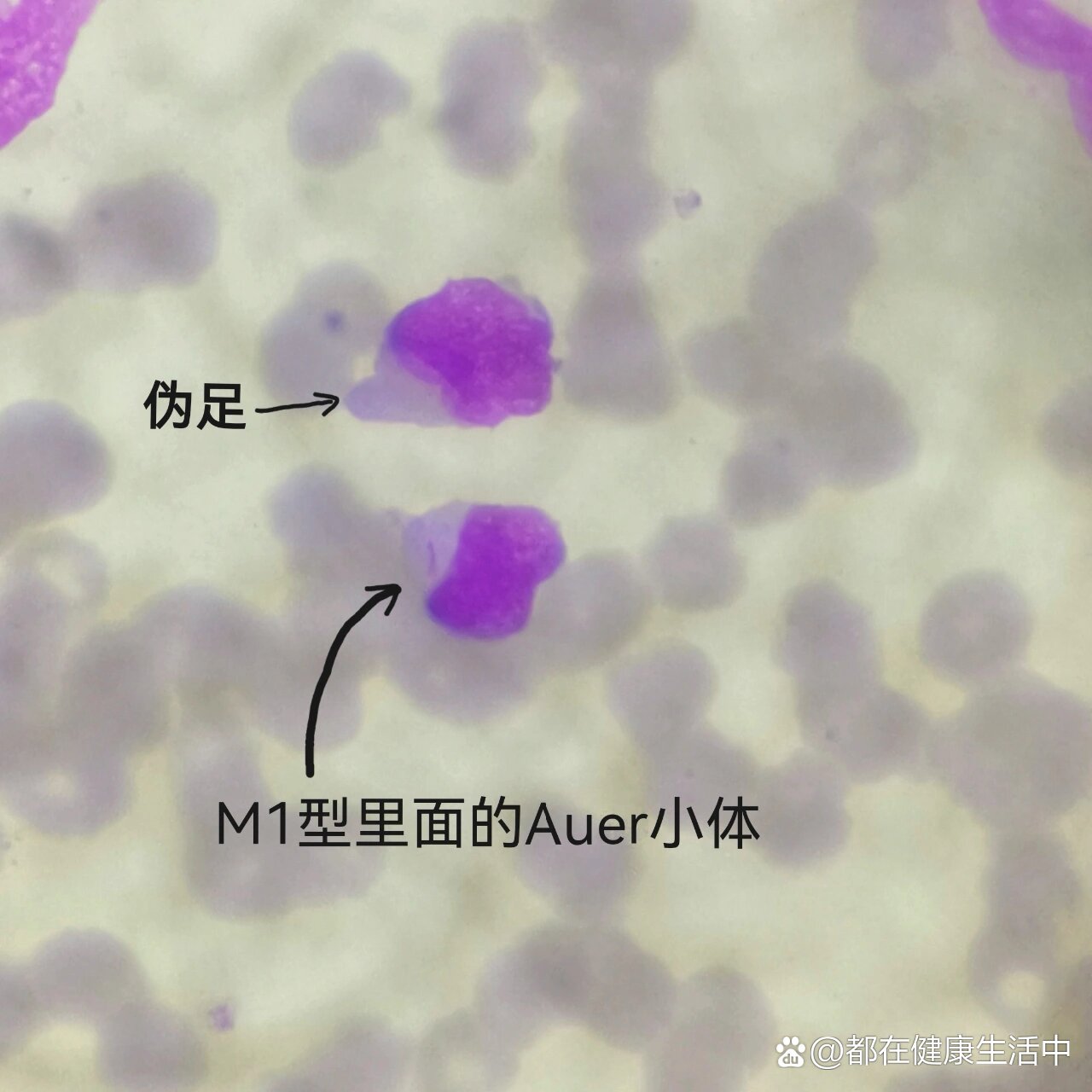 x小体的细胞图图片