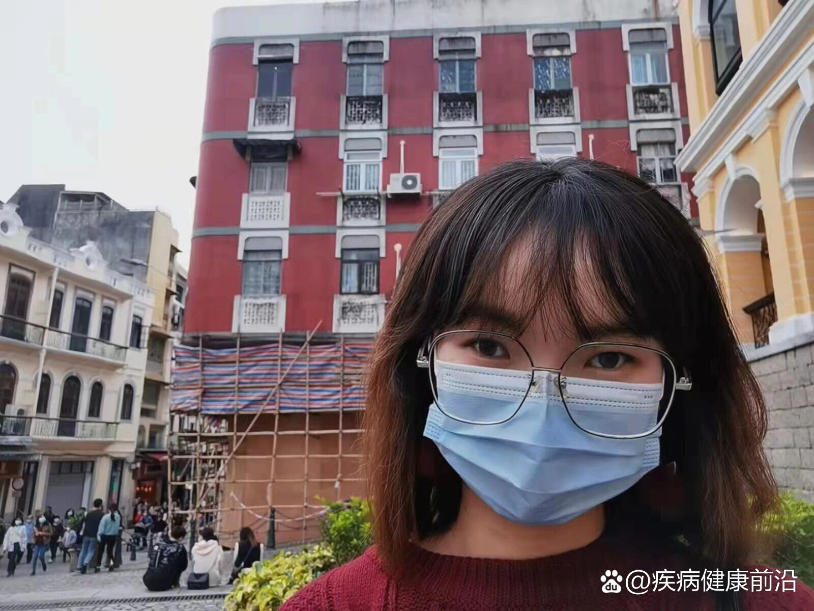 废用性斜视||中山眼科