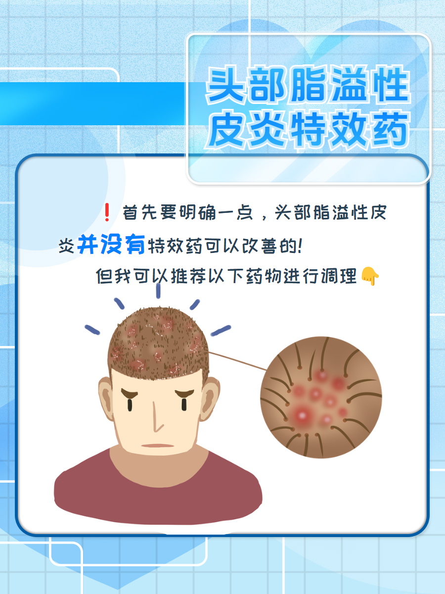 头部脂溢性皮炎的特效药你知道吗?
