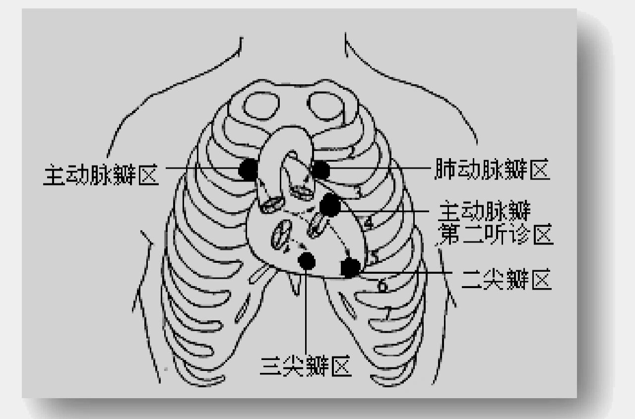 心脏瓣膜听诊区示意图图片