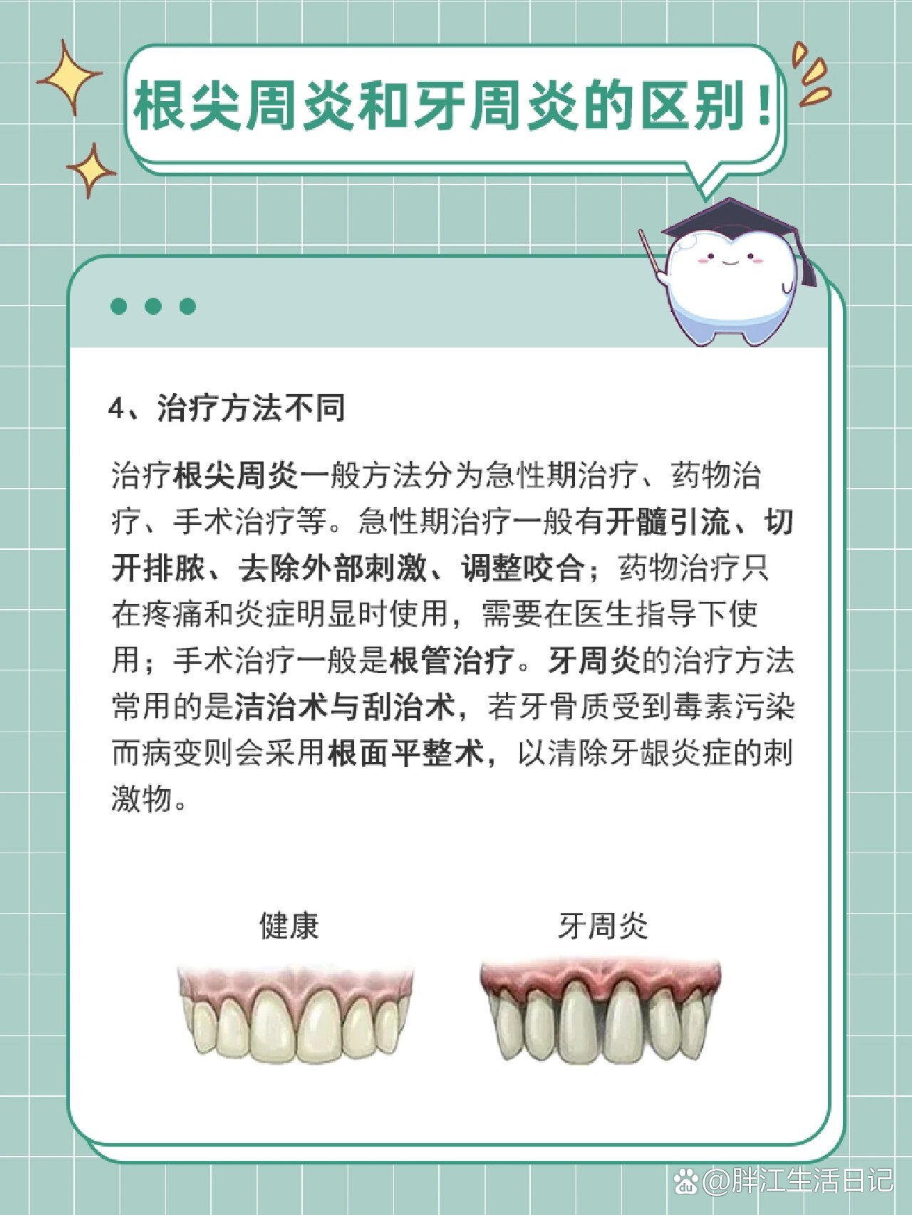 根尖周炎和牙周炎的区别7575