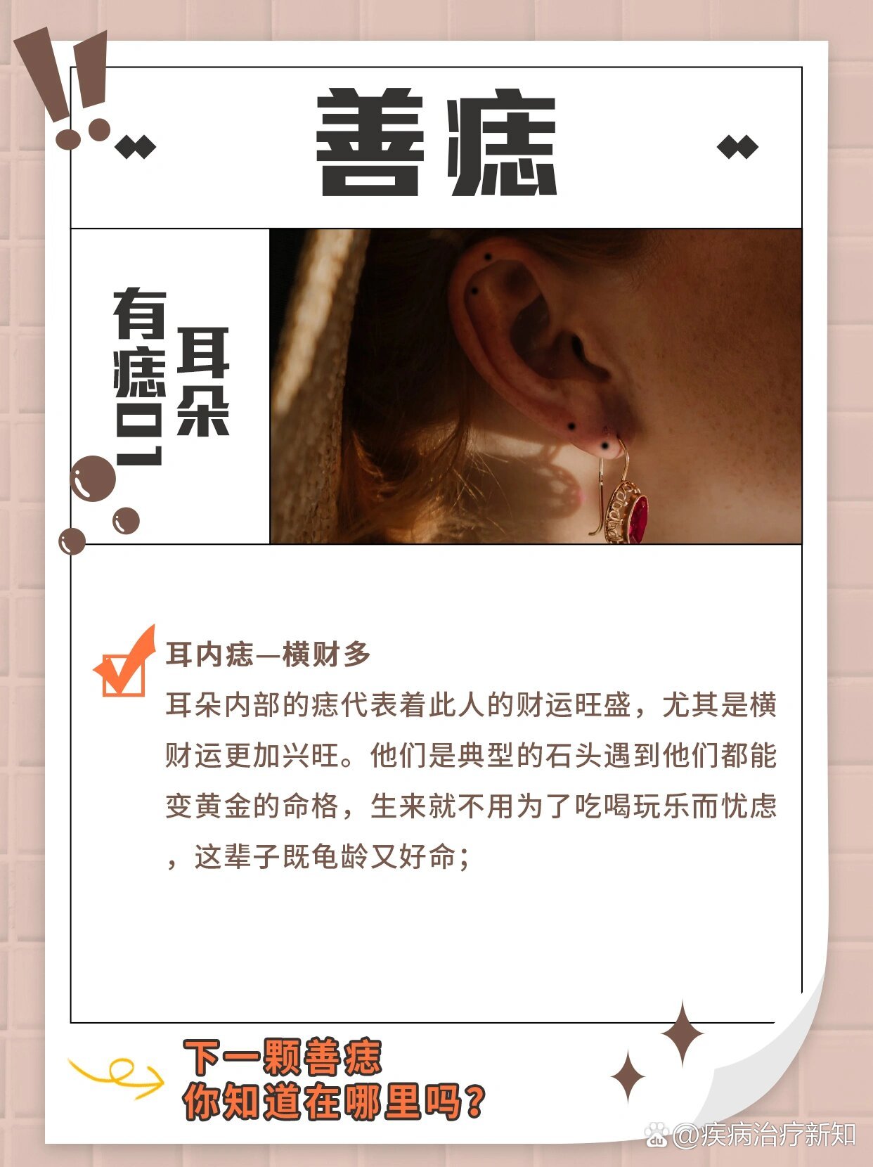 善痣——耳上有痣9099