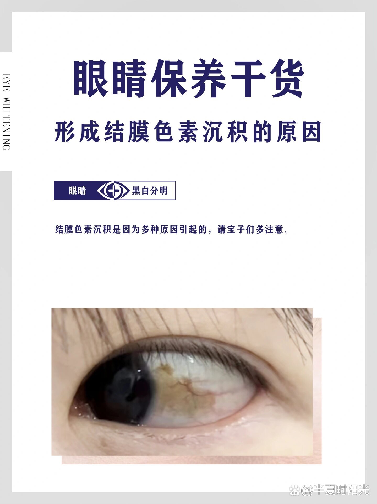 请宝子们多注意: br>16615年龄:结膜是眼球表面的薄膜,随着年