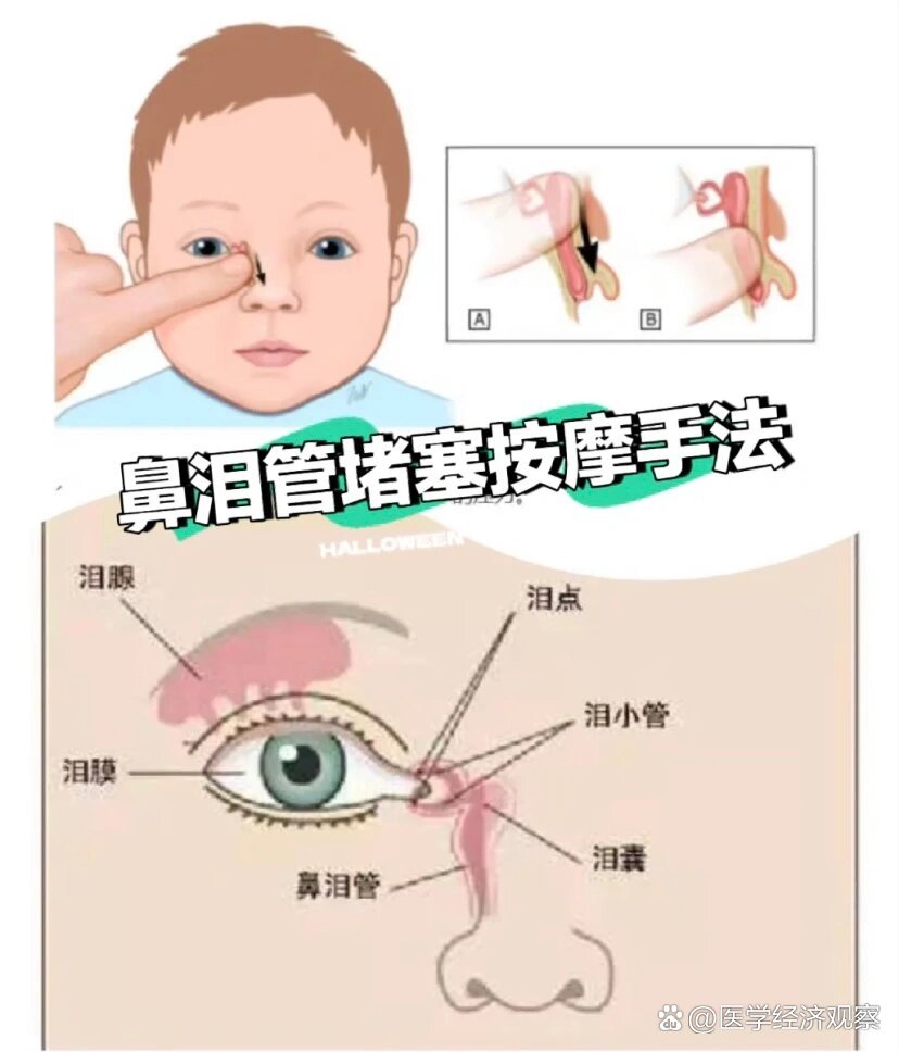 泪小管狭窄按摩手法图片