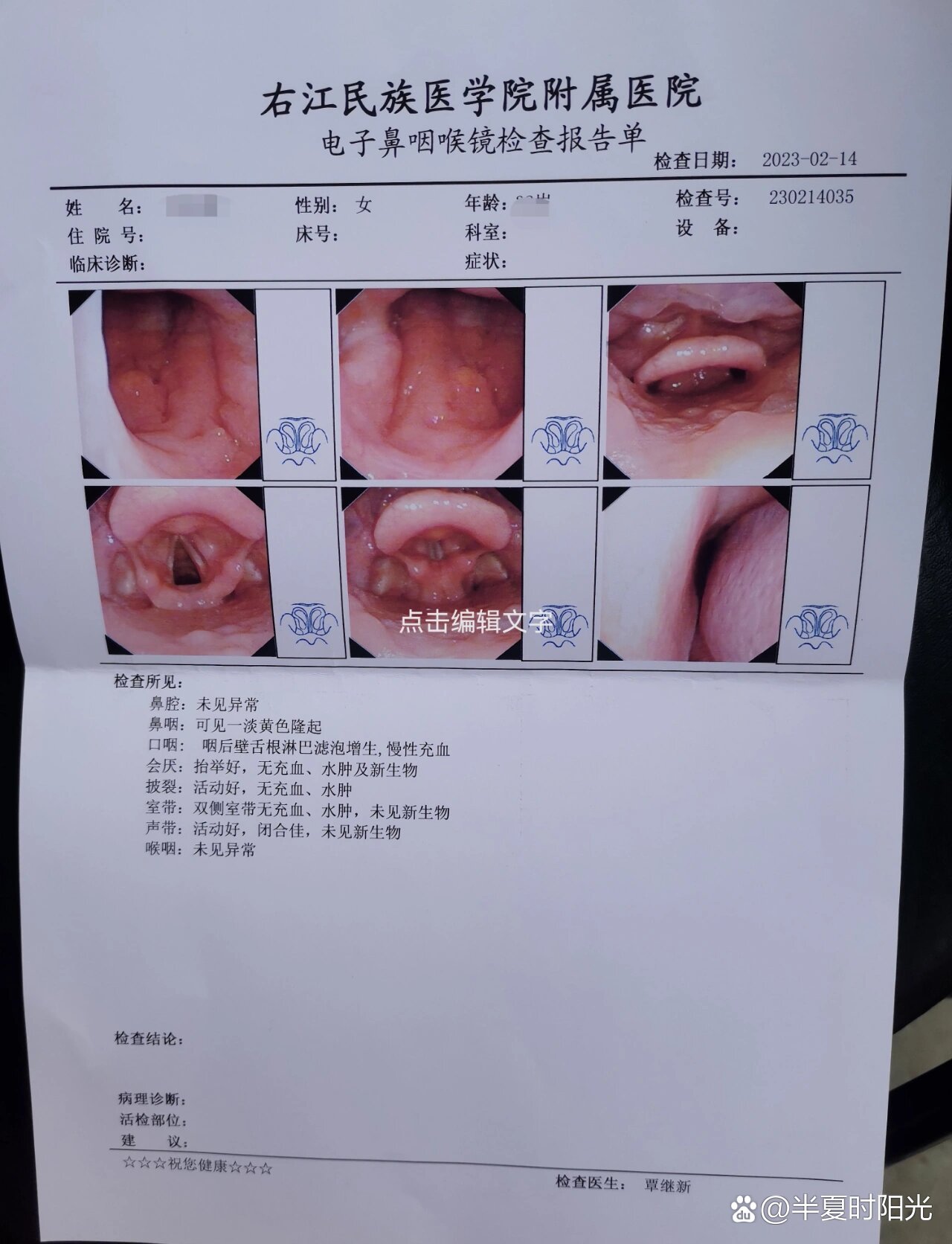 慢性咽炎照片图片