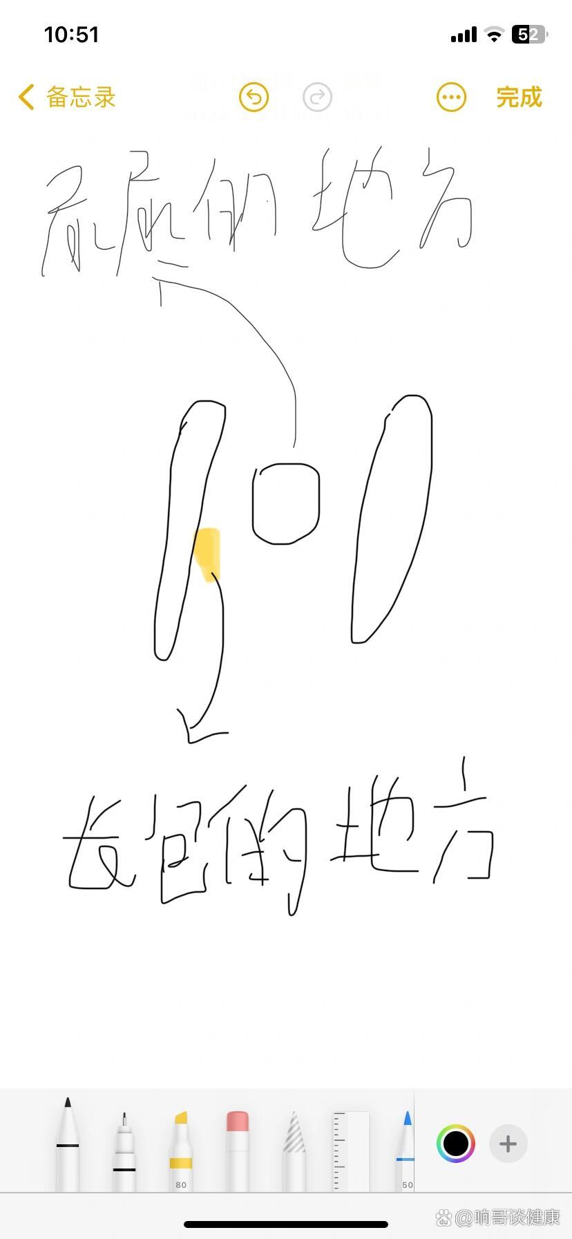 女生尿道口旁边的缝隙里长了个泡