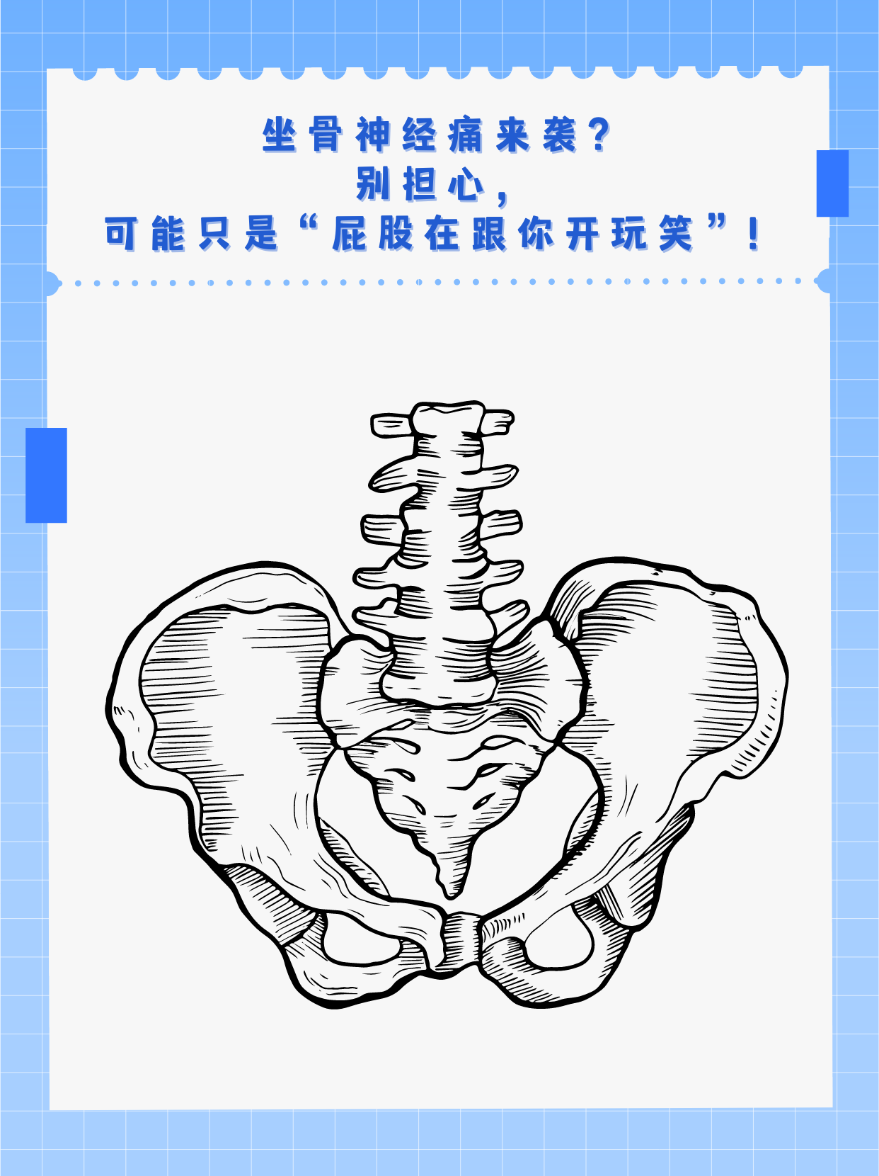 坐骨神经痛来袭?别担心,可能只是"屁股在跟你开玩笑"!