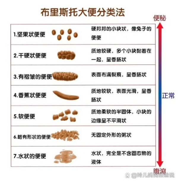 婴儿便便形状图解图片