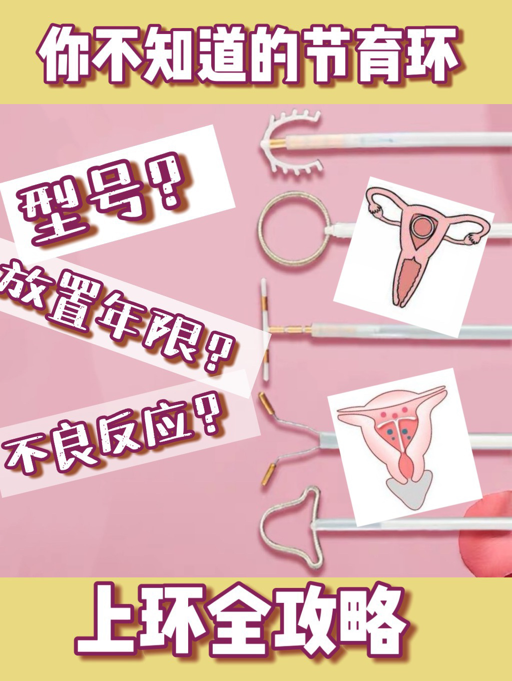 你不知道的节育环|9399上环全攻略6015