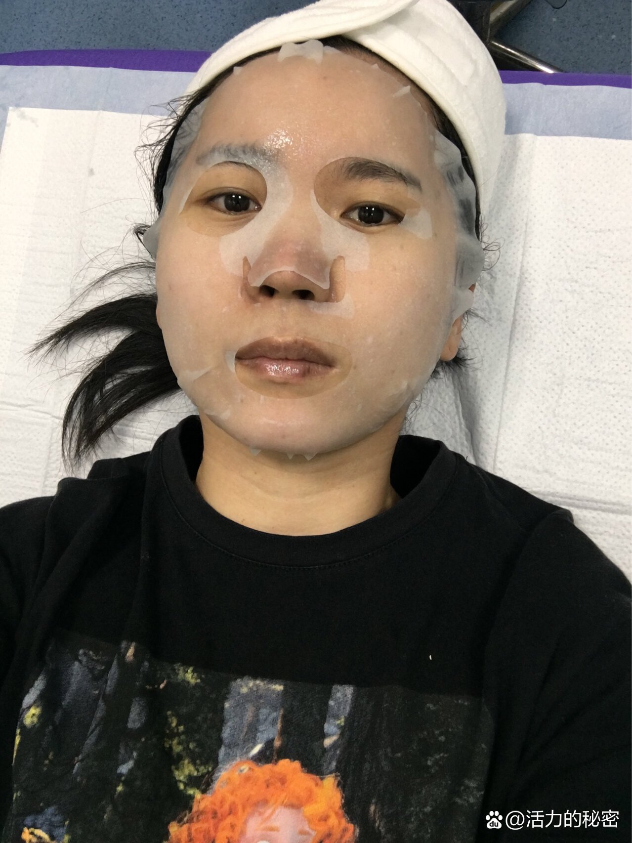 果酸换肤,价格是700一次,说是四次一个疗程,我的皮肤问题主要是色素沉