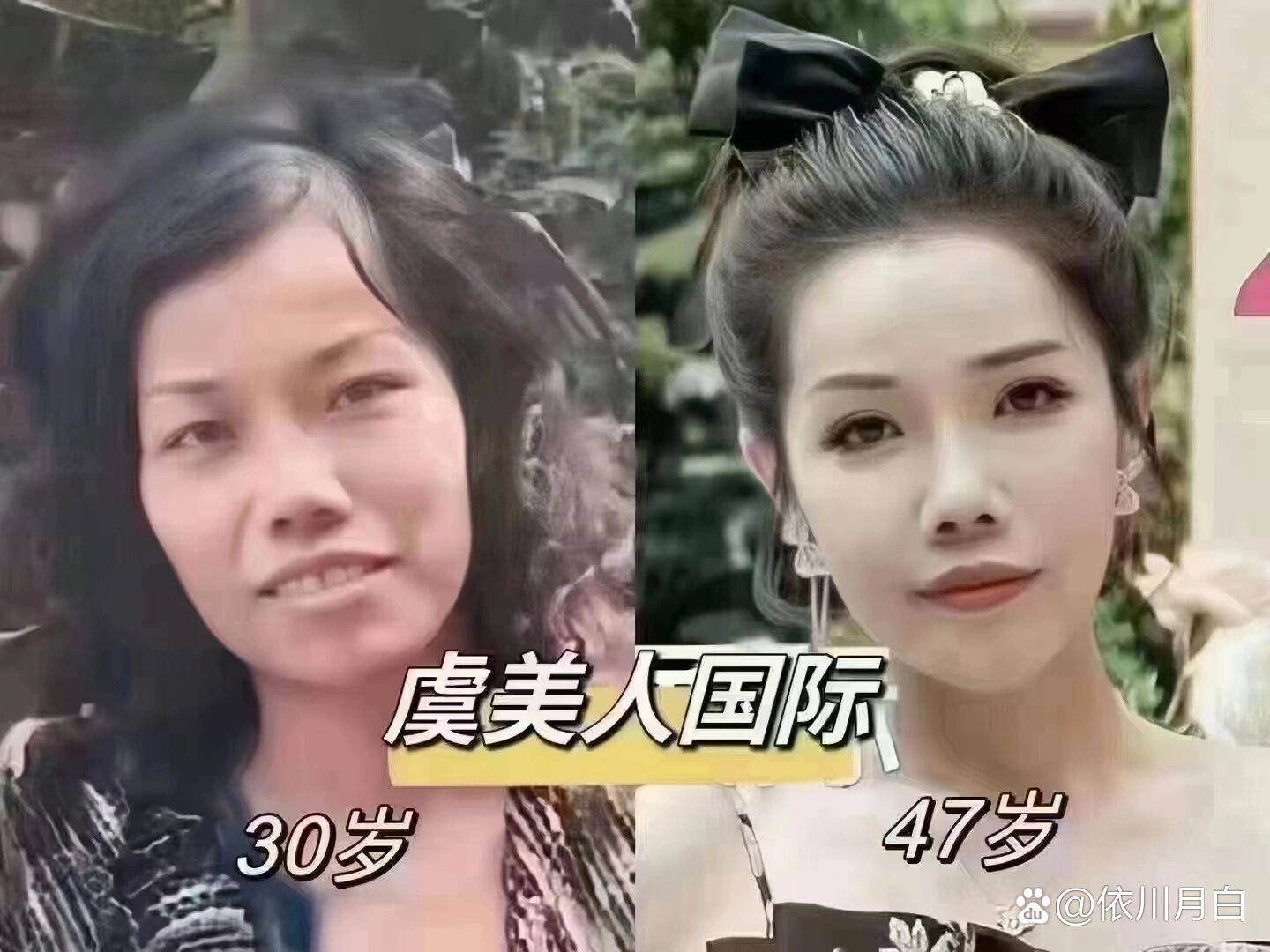 虞美人老总整容前照片图片