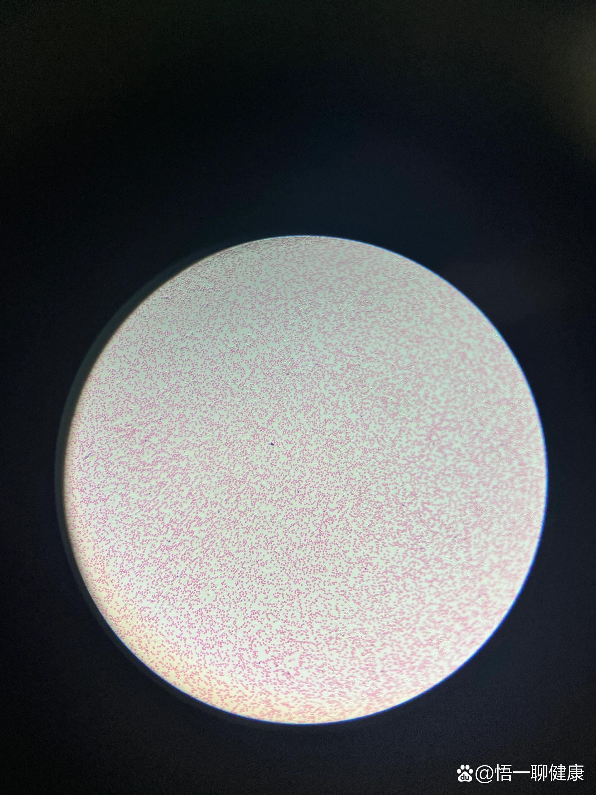 显微镜94下的人血涂片