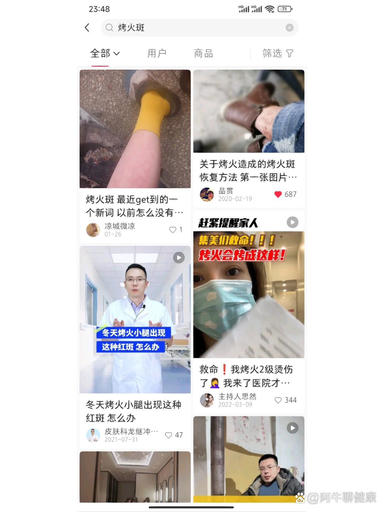 烤火斑怎么消除图片